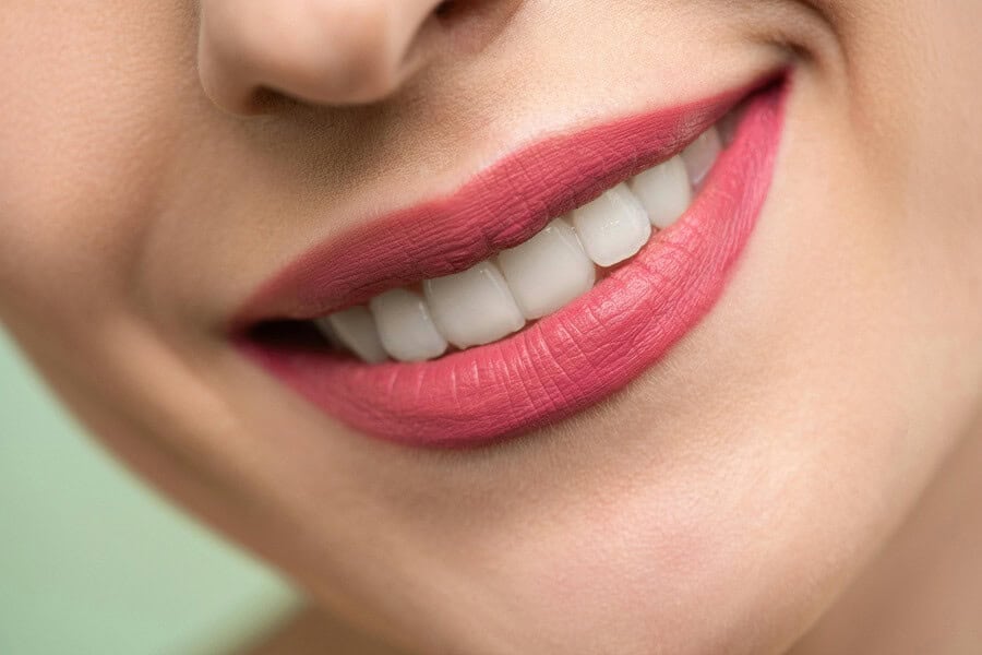 How to Keep Your Teeth Healthy