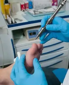 Podiatrist performing foot treatment with precision tools.